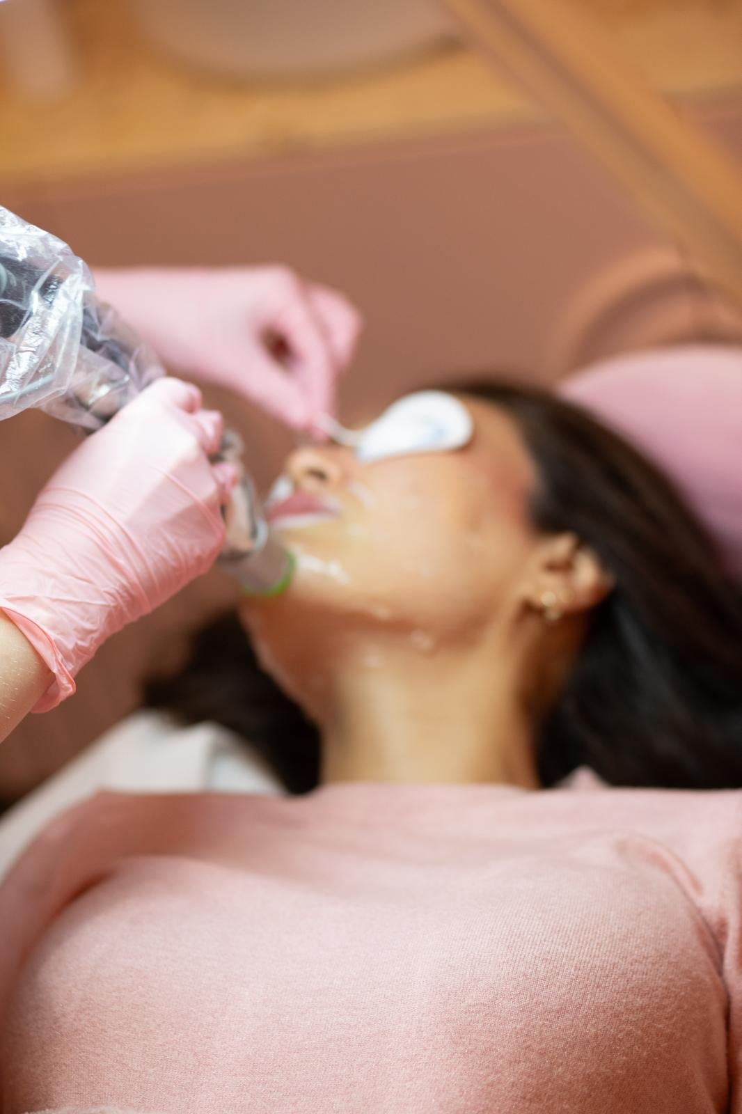 Laser-Haarentfernung Gesäß 1 Laser Haarentfernung im Gesicht mit DEKA Alexandrit-Laser – DYVO Beauty Studio Frankfurt