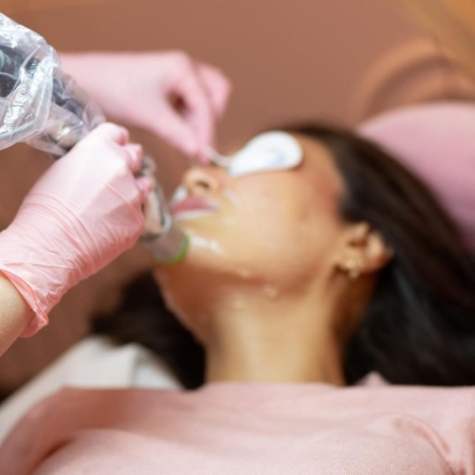 Laser Haarentfernung im Gesicht mit DEKA Alexandrit-Laser – DYVO Beauty Studio Frankfurt